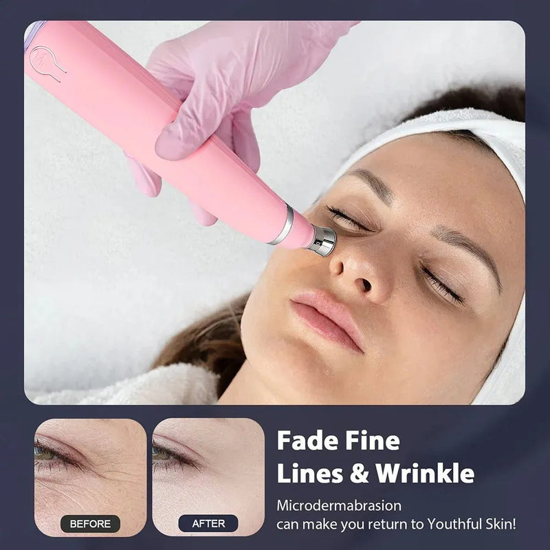 Diamond Microdermabrasion Machine – 3 Modes 8 Tips Blackhead Removal Tool