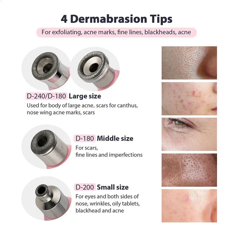 Diamond Microdermabrasion Machine – 3 Modes 8 Tips Blackhead Removal Tool