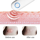 Portable Anti-Itch Device Insect Bite Healer – Rechargeable Mosquito Bite Relief for Outdoor Use