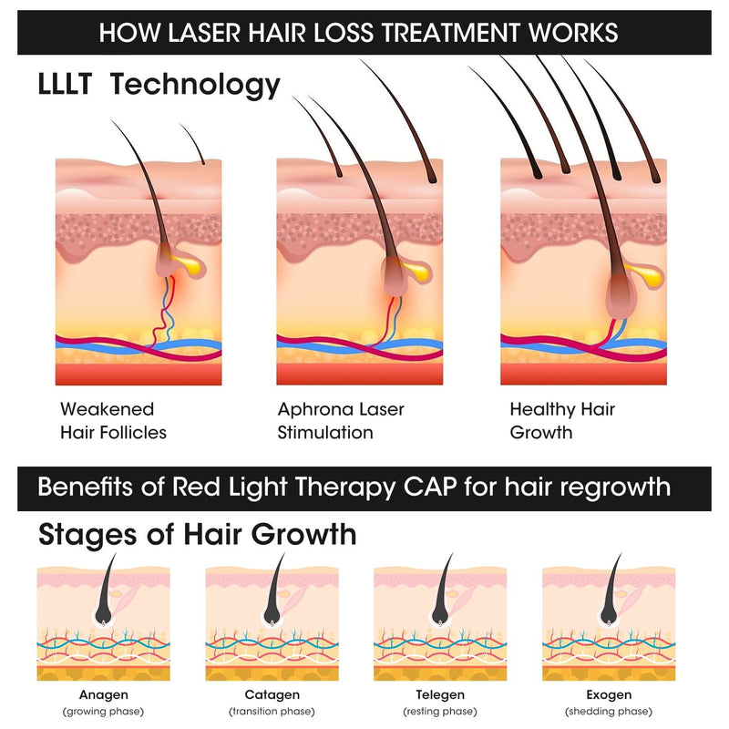 LED Hair Growth Cap – 100 LED Beads 660nm/850nm Red Light Therapy Hat