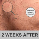 Derma Roller – Microneedle Roller for Face Beard & Scalp