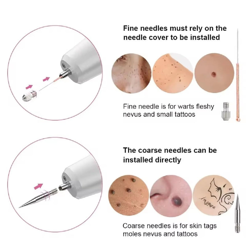 Plasma Mole Skin Tag & Spot Remover Pen – Multi-Speed LCD Laser Tool for Skin Care