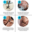 Derma Roller – Microneedle Roller for Face Beard & Scalp