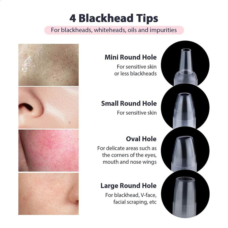 Diamond Microdermabrasion Machine – 3 Modes 8 Tips Blackhead Removal Tool