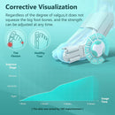 Adjustable Bunion Corrector - Hallux Valgus Natural Treatement