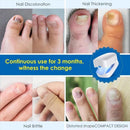 Nail Fungus Laser Treatment - Revolutionary High-Efficiency Light Therapy