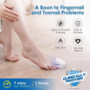 Nail Fungus Laser Treatment - Revolutionary High-Efficiency Light Therapy