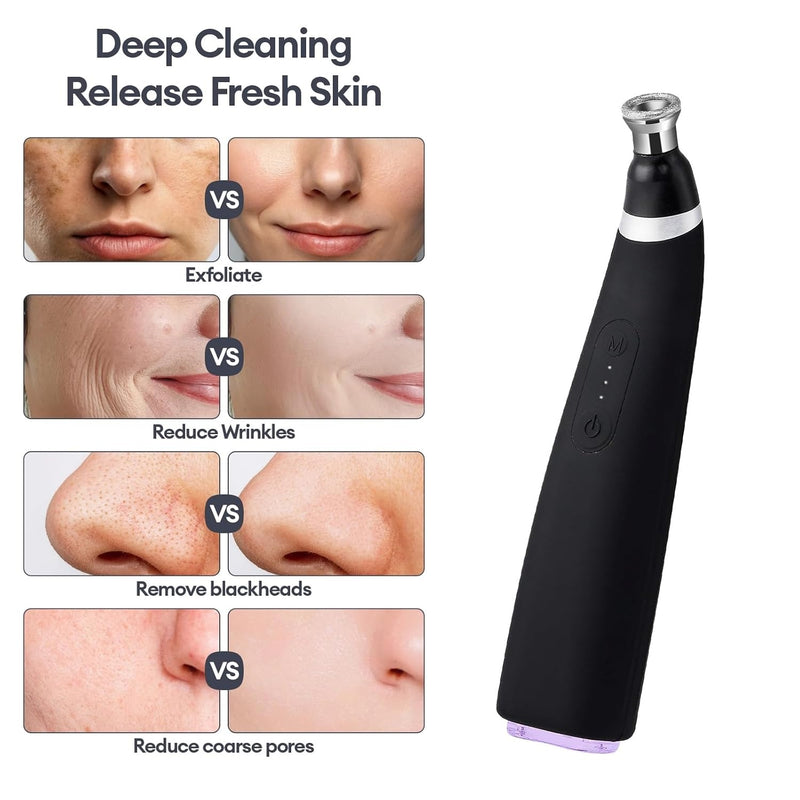 Diamond Microdermabrasion Machine – 3 Modes 8 Tips Blackhead Removal Tool