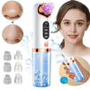 Blackhead Remover - Pore Vacuum
