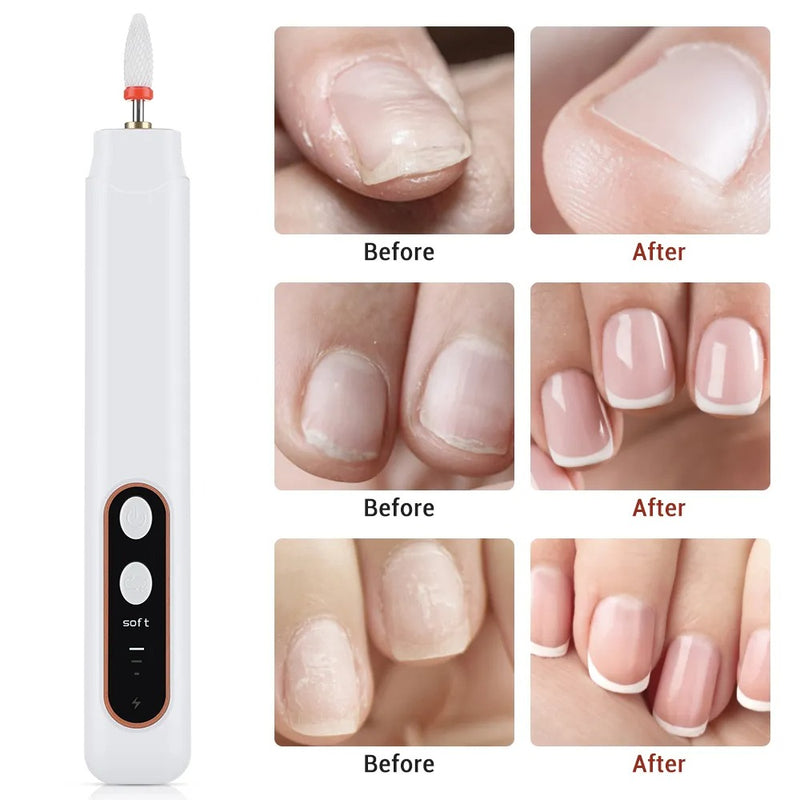 Electric Nail File – 15 000RPM Manicure Set with 6 Bits
