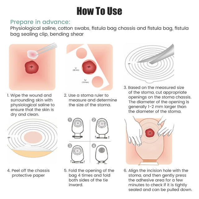 Adult Colostomy Bags – 10-Pack 20–65mm Disposable Ostomy Pouches